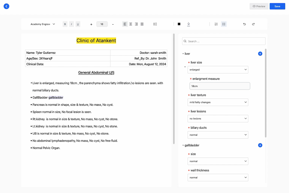 How Custom Template Options Work